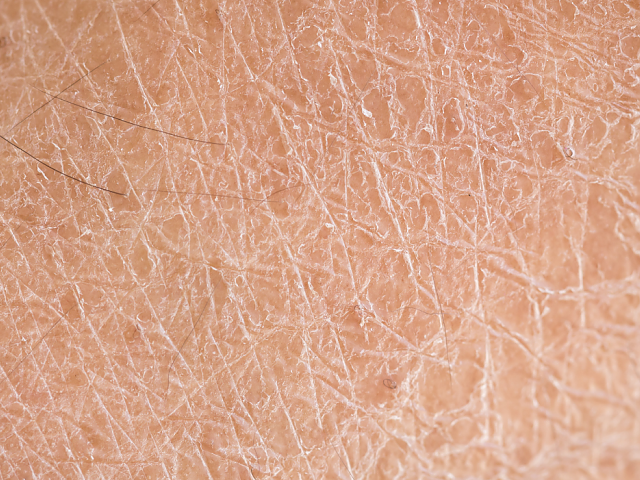 La importacia del Ácido hialurónico en la piel
